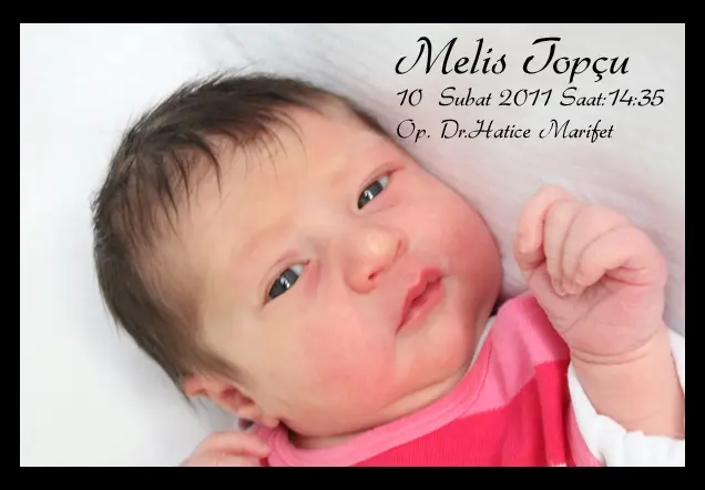 Melis Topçu galerisi kapak fotoğrafı